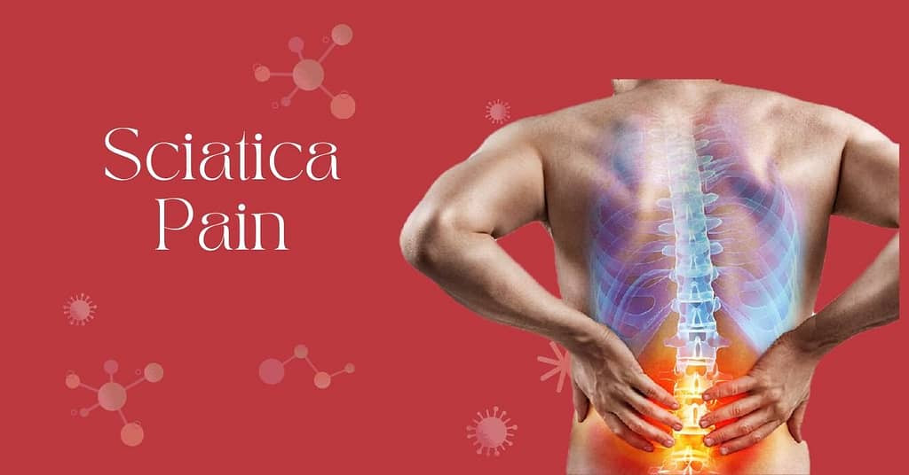 Sciatica Pain